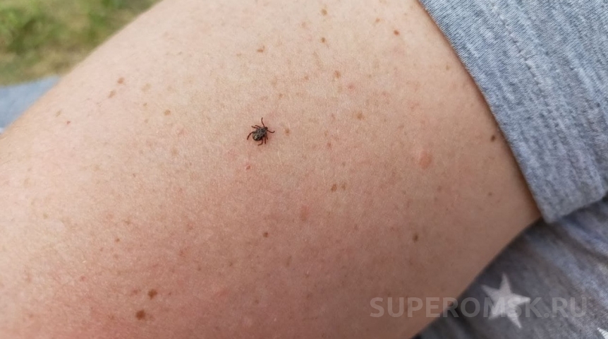 Количество пострадавших от укусов клещей в Омской области почти удвоилось