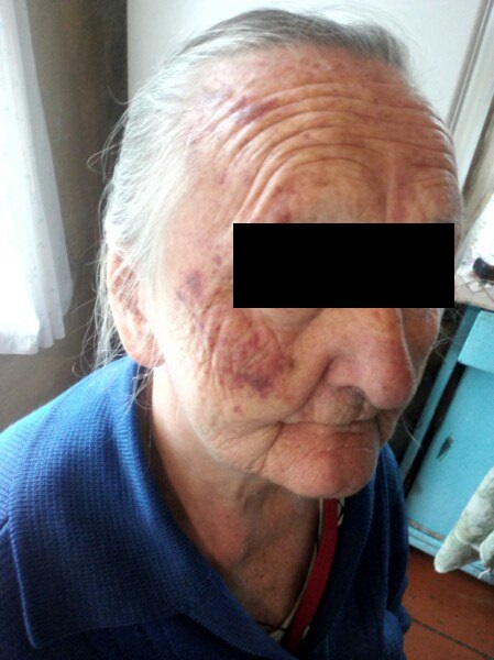 Жертва колосовского Раскольникова: «Если его оставить на свободе, обязательно будет труп» Жертва колосовского Раскольникова: «Если его оставить на свободе, обязательно будет труп»